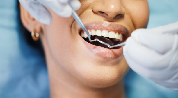 Best Emergency Wisdom Tooth Extraction in La Puebla, NM
